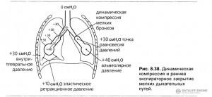 АутоПДКВ (AutoPEEP). Динамическое перераздувание легких